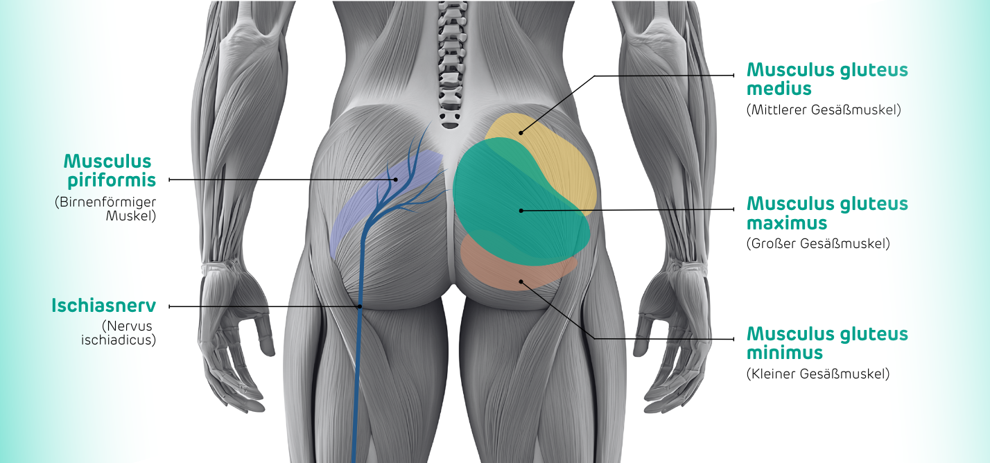 Anatomische Illustration von Gesäßmuskulatur und Ischiasnerv 