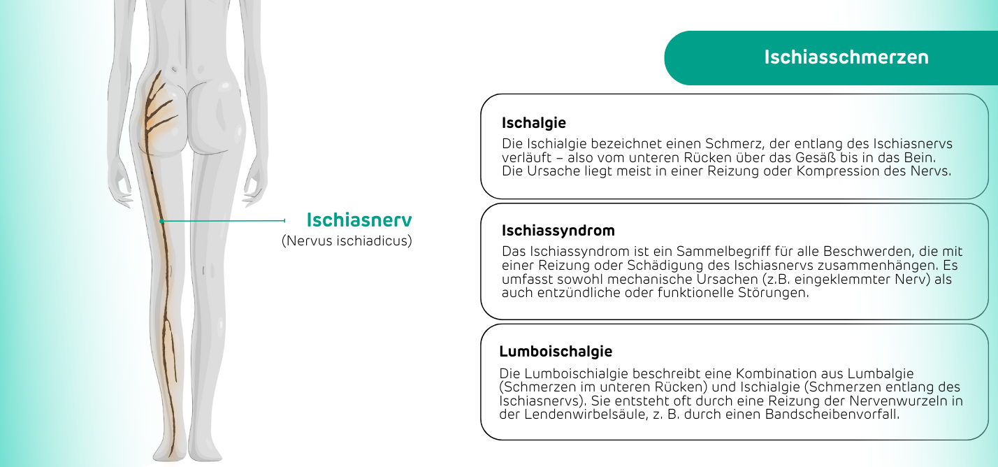 Schematische Darstellung des Ischiasnervs mit Markierung des Schmerzverlaufs und Erläuterungen 